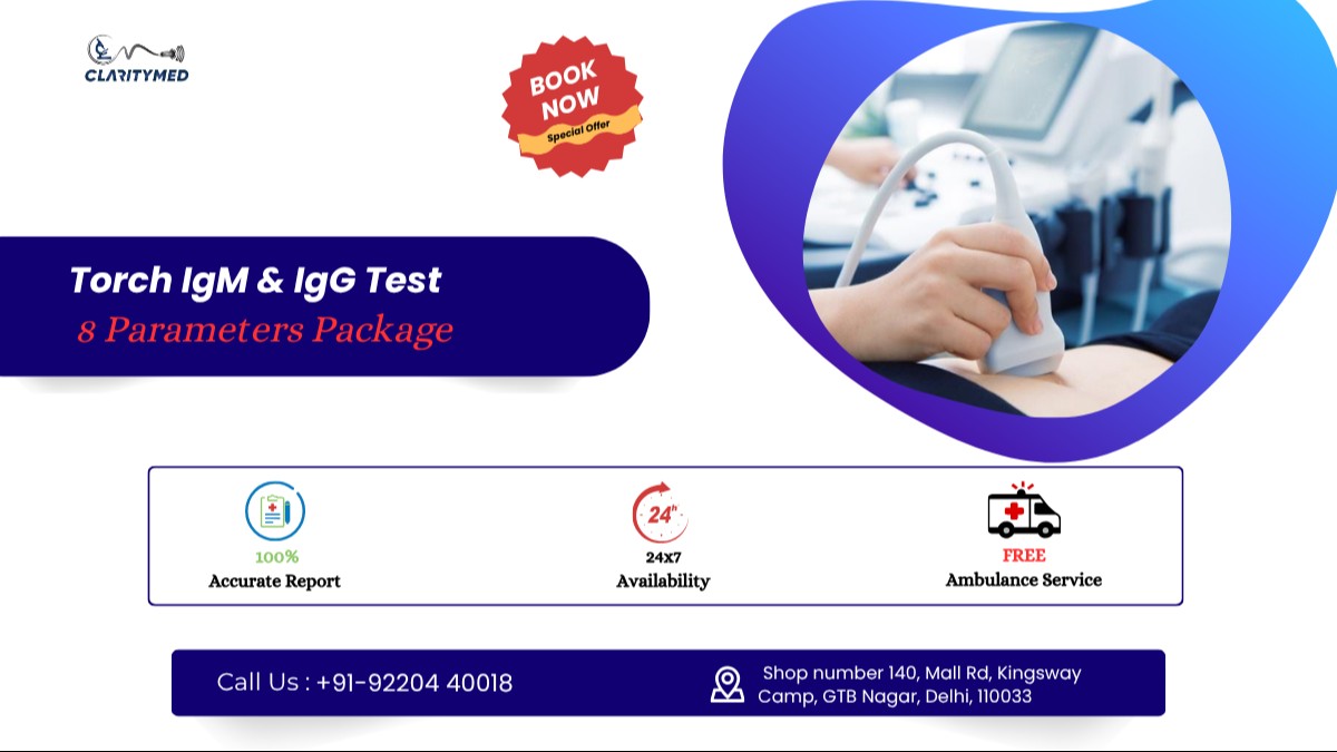Torch IgG IgM Test 8 Parameter Package